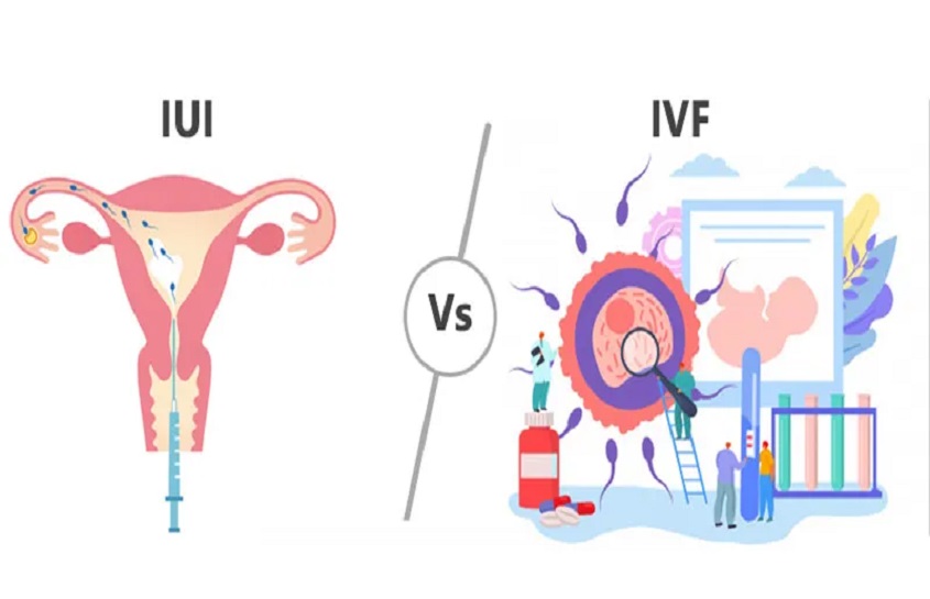 IVF and IUI